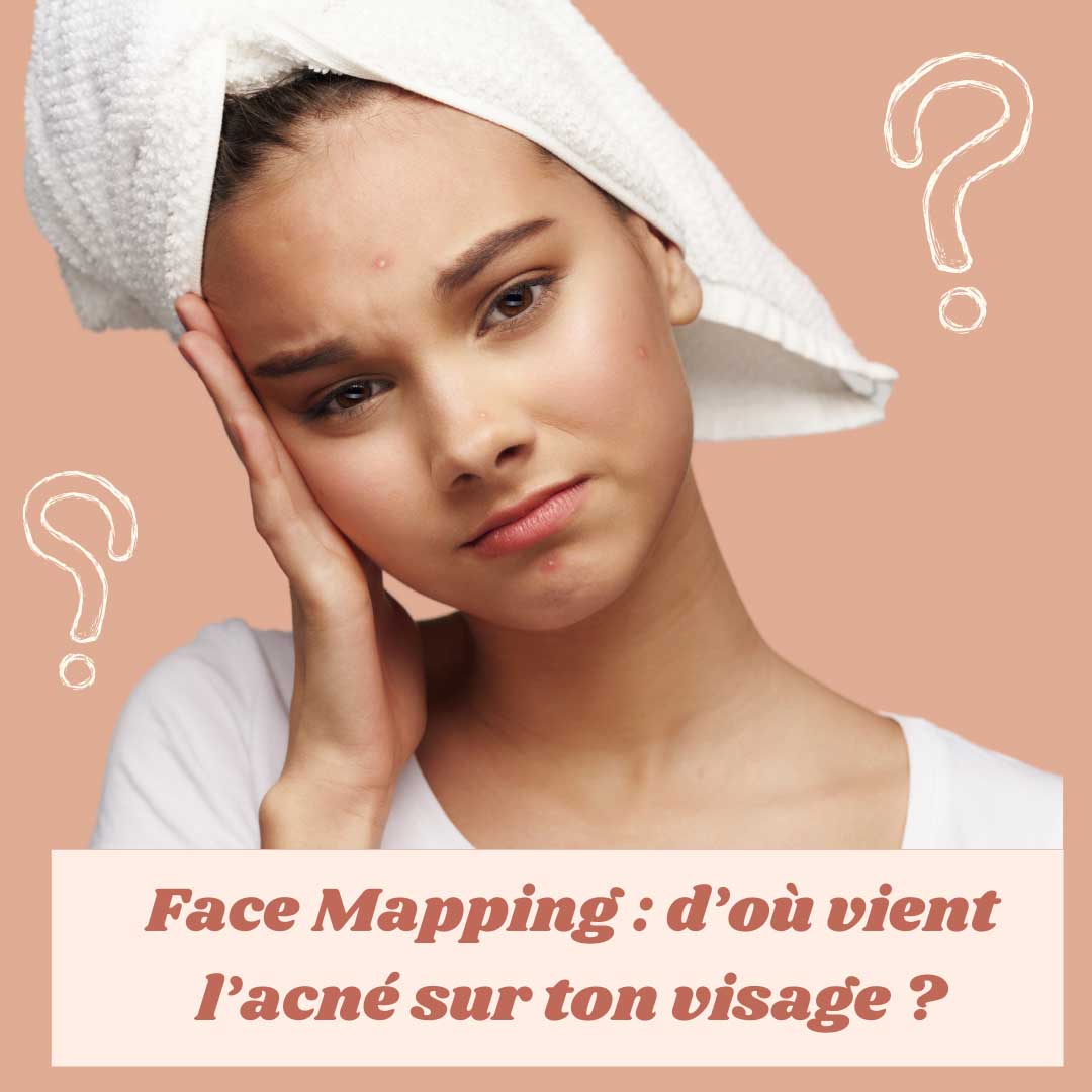Face mapping, d'où vient l'acné sur le visage ?