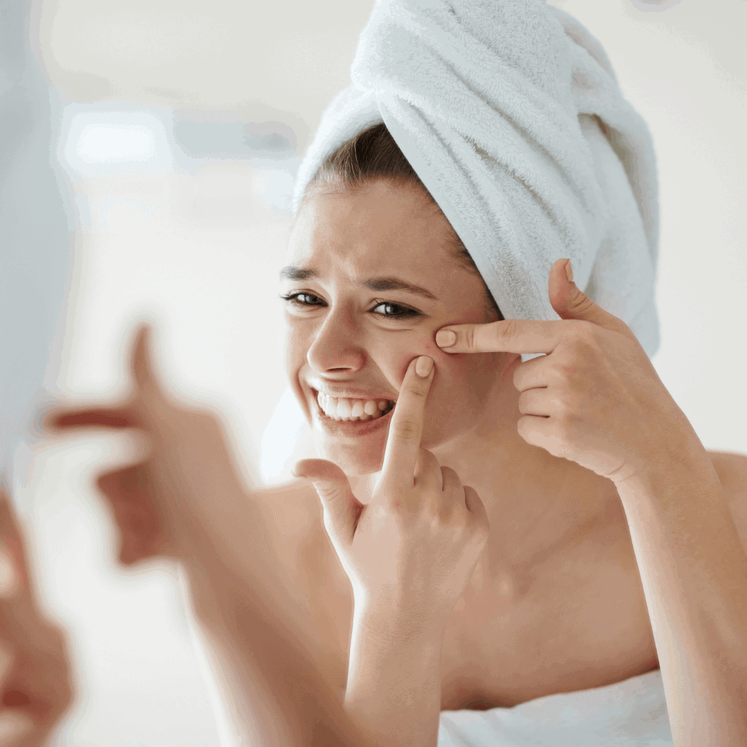 Comment se débarrasser des cicatrices d'acné? Solutions beauté by S and Vaë