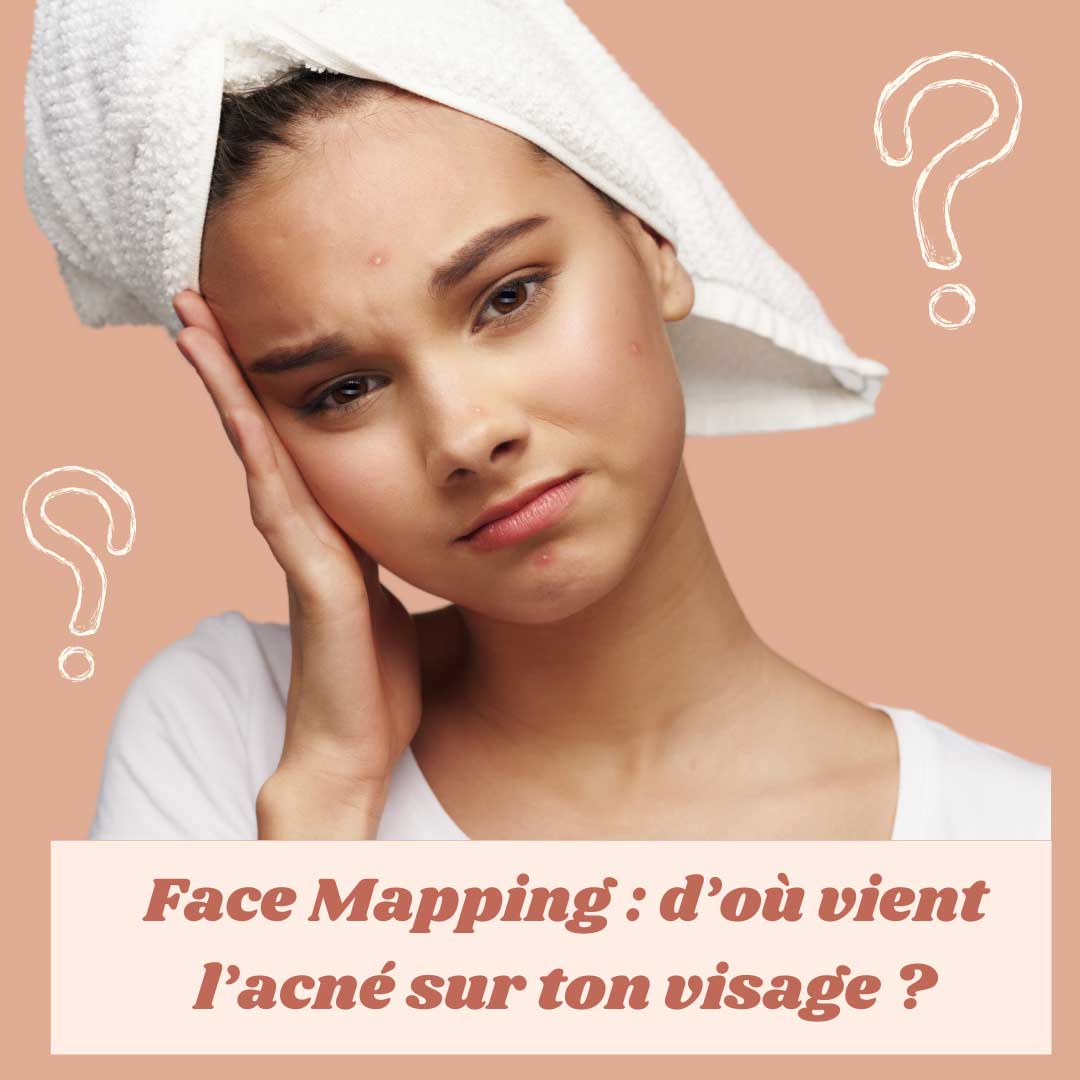 Face mapping, d'où vient l'acné sur le visage ? 